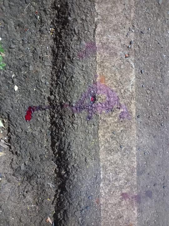Foto 3 de 4 — Ciclista sofre grave acidente após queda de bike próximo a cutrale em Araraquara